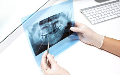 ¿Puedo hacerme una radiografía llevando brackets?