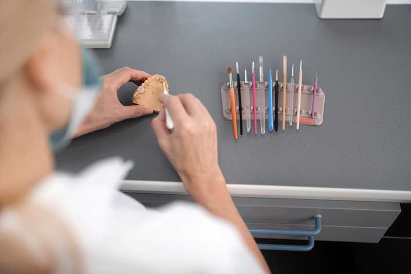 Fundas dentales | Clínica Dental Parque