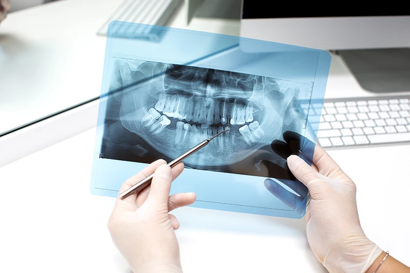 dentista endodoncia Dentista endodoncia | Clínica Dental Parque