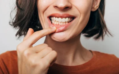 ¿Demasiada encía al sonreír? La sonrisa gingival