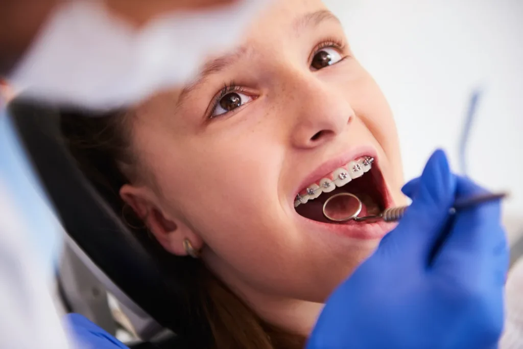 chica con Brackets en el dentista
