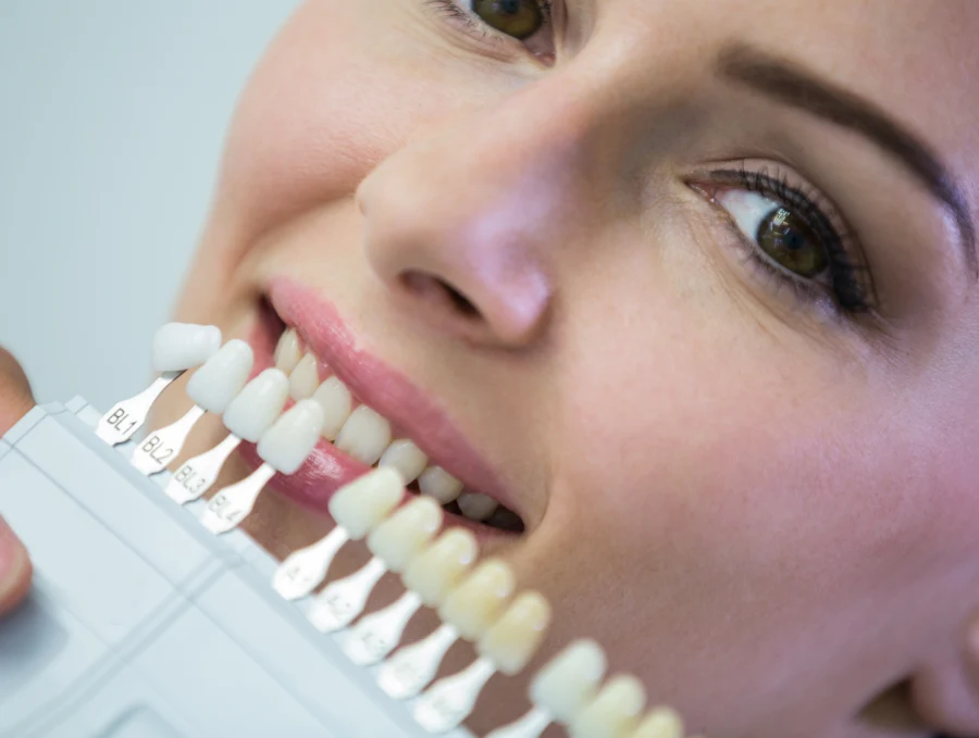 dentista de carillas dentales